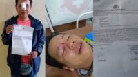 Mengaku Anak Pejabat, Pelaku AS Aniaya Korban Membabi Buta di Depan Umum
